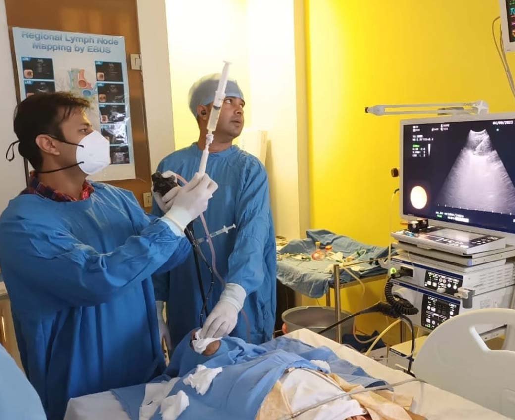 Interventional pulmonology procedure by Dr. Manan Bedi
