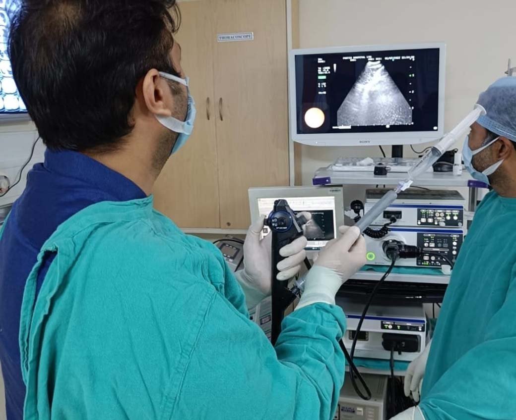 Interventional pulmonology procedure by Dr. Manan Bedi